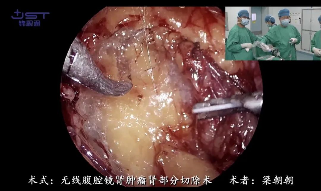 1690773115236468.jpg 1690773115236468.jpg